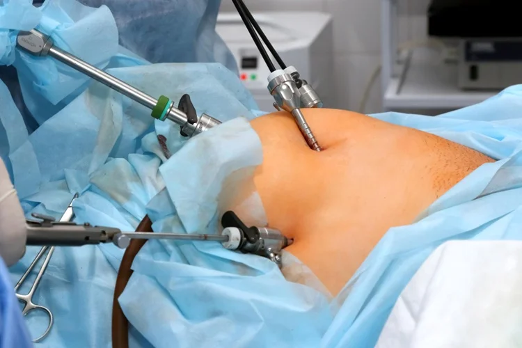Hernia Repair Surgery
