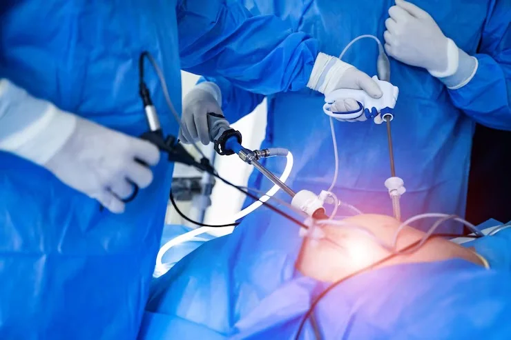Laser Surgical Procedures