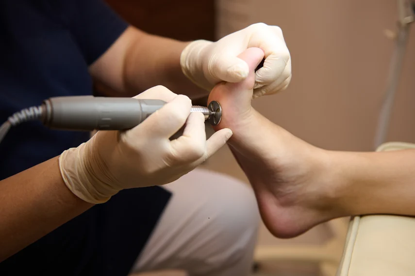 Diabetic Foot Care & Surgery