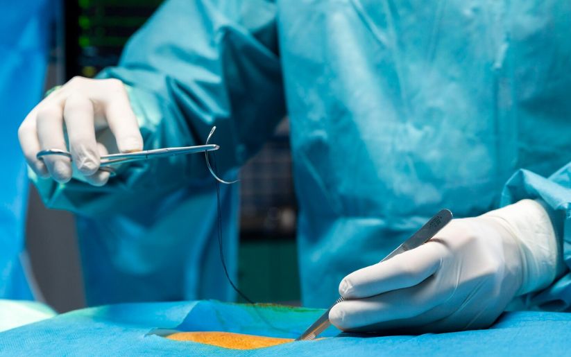 Appendix Surgery (Appendectomy)